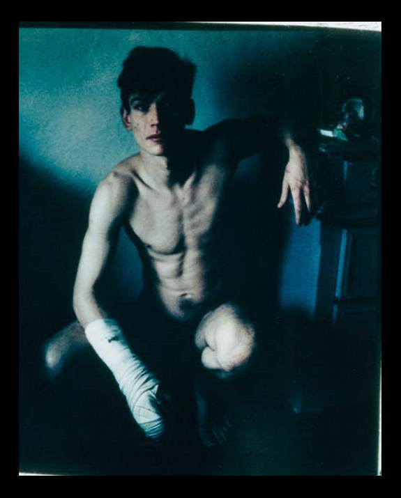 Mark Morrisroe | Self-Portrait With Broken Finger, Christmas 1984, 1984  C-print, negative sandwich
